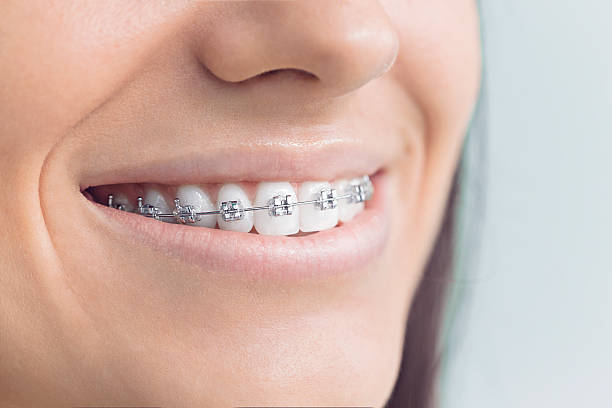 Best Traditional Braces  in Perryton, TX